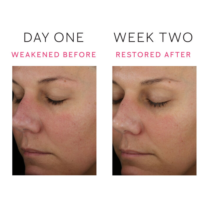 Mary Kay Clinical Solutions® Barrier Restore 1:1:3